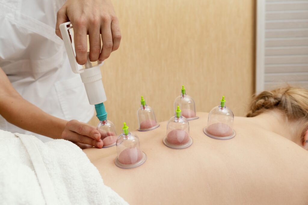 Hijama Therapy (Cupping Therapy)
